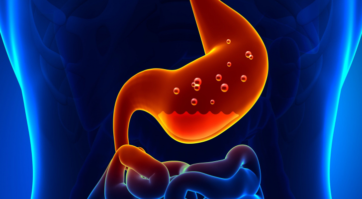 نصائح غذائية لمرضى الإرتداد المريئي في رمضان
